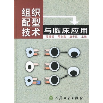 组织配型技术与临床套用
