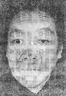甲状腺功能亢进面容 甲状腺功能亢进面容